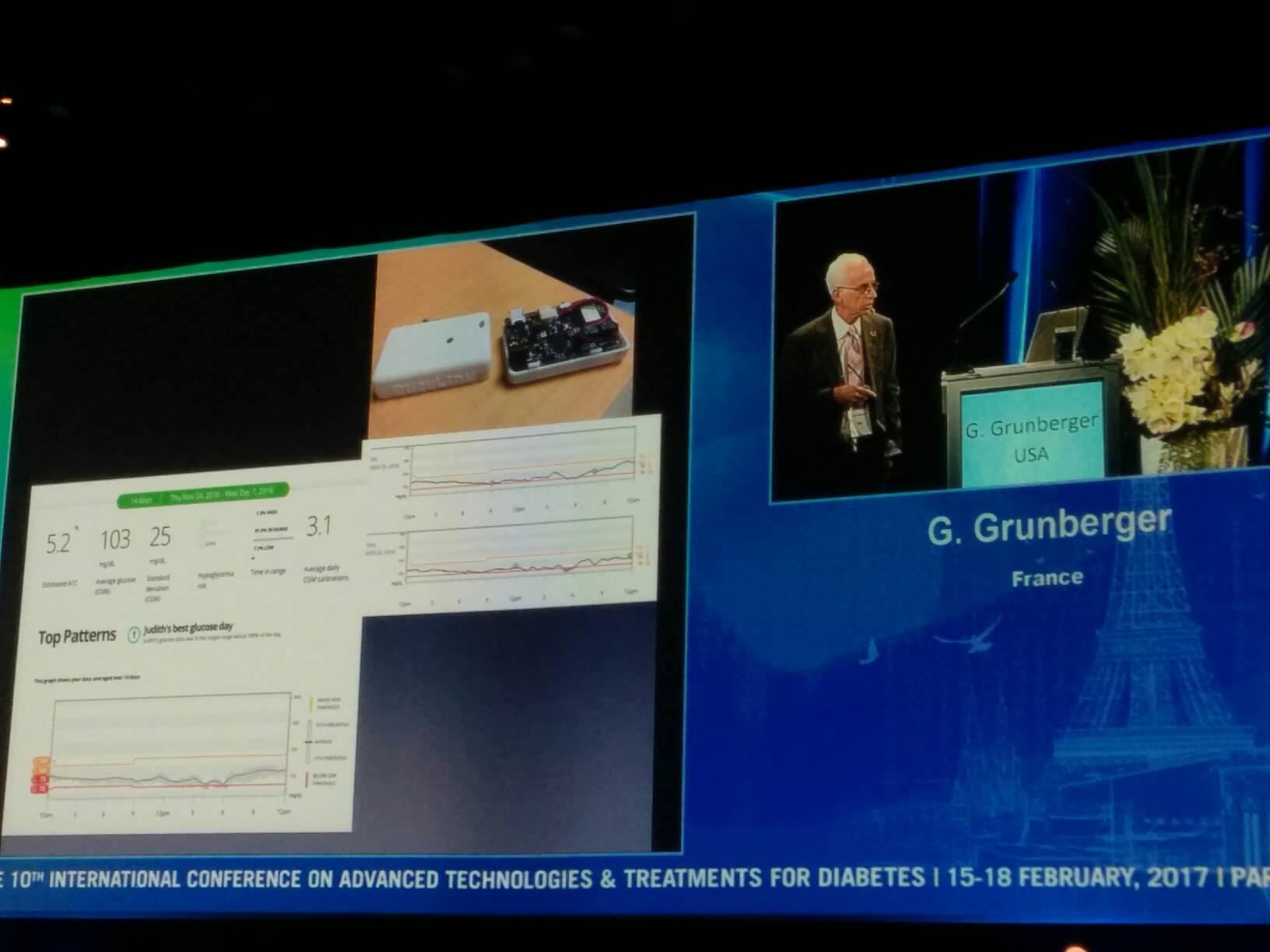 65 year old patient has significant improvement in BG control, how? Her son setup OpenAPS! ATTD 2017